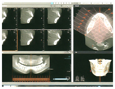 歯科用CT