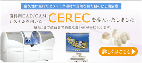 セレックを導入しています