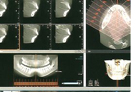 歯科用CT完備